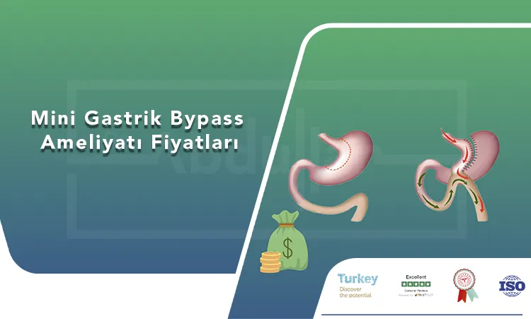 Mini Gastrik Bypass Ameliyatı Fiyatları