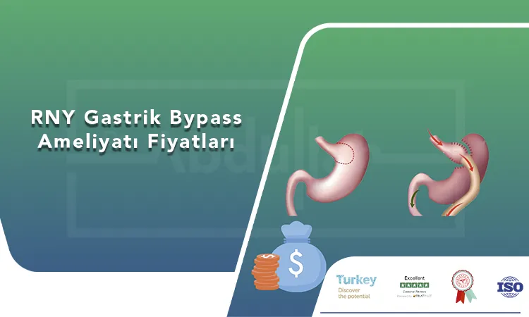 RNY Gastrik Bypass Ameliyatı Fiyatları